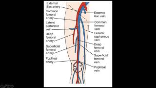 Lower Extremity Deep Venous Thrombosis DVT [upl. by Kathleen]