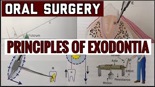 PRINCIPLES OF EXODONTIA II TOOTH EXTRACTION II ORAL SURGERY II imp [upl. by Aivekal53]