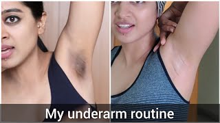 How I Got Rid of My Dark Underarms [upl. by Notsnorb93]