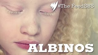 Albinos In Brazil [upl. by Derfniw28]