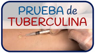 PRUEBA DE TUBERCULINA  ¿Cómo se realiza [upl. by Phillida]