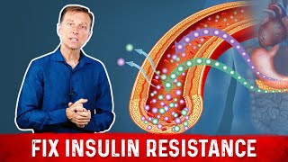 7 Things That Boost Insulin Sensitivity or Reverse Insulin Resistance  Dr Berg [upl. by Eikcin33]