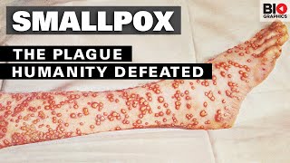 Smallpox The Plague That Humanity Defeated [upl. by Burnard501]