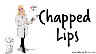 Chapped Lips Healing Tips from Dermatologist  Dr Bailey Skin Care 2017 [upl. by Presley]