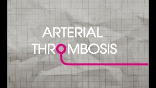 Arterial Thrombosis Explained [upl. by Haneekas]