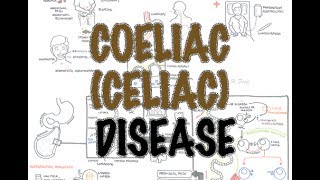 The Gluten Free Diet  Coeliac UK [upl. by Haimrej]