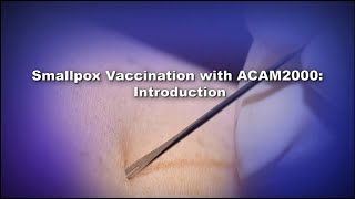 Chapter 1 Smallpox Vaccination with ACAM2000 Introduction [upl. by Litton822]