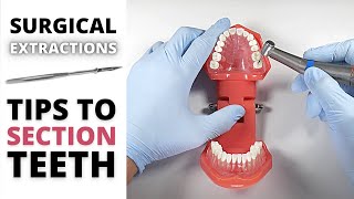 SURGICAL EXTRACTION SECTIONING TIPS  OnlineExodontiacom [upl. by Hatch916]