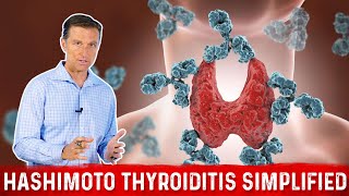 HASHIMOTOS THYROIDITIS Living with Autoimmune Disease [upl. by Pas59]