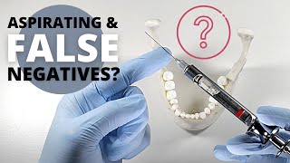 What Most Dentists Dont Know About Aspirating  OnlineExodontiacom [upl. by Tabb]