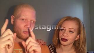 Albinism amp Nystagmus [upl. by Udella]