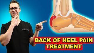 Retrocalcaneal Heel BURSITIS Treatment Heel Pain Exercises amp Massage [upl. by Canute]