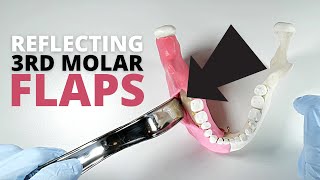 How To Reflect And Retract A FullThickness Flap For Third Molar Surgery  OnlineExodontiacom [upl. by Eniamraj]