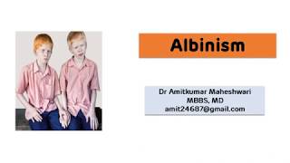 Albinism  Deficiency of Tyrosinase [upl. by Jordanson791]