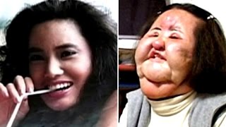 10 Worst Plastic Surgeries Disasters [upl. by Auqcinahs]