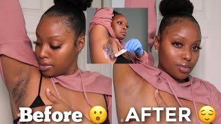 WAX Your Underarms AT HOME  How To Lighten Dark Underarms Naturally Detailed [upl. by Eimia195]