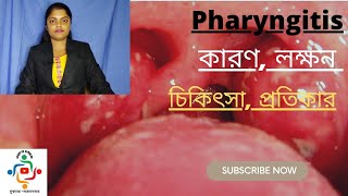 Pharyngitis In Bangla  Causes  Treatments  Home Remedies [upl. by Pesek]