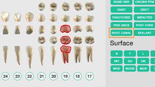 Dental Assisting  Patient Exam [upl. by Sandell276]