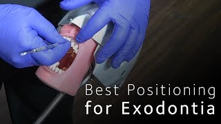 Best Positioning for Minimally Invasive Exodontia [upl. by Ecnarretal]