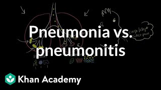 Pneumonia vs pneumonitis  Respiratory system diseases  NCLEXRN  Khan Academy [upl. by Menell209]