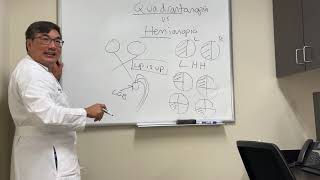 Quadrantanopia vs hemianopia [upl. by Denise]