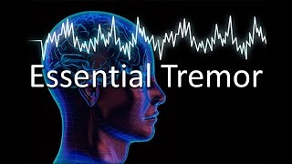 Essential Tremor [upl. by Rayburn528]