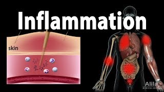 Inflammatory Response Animation [upl. by Gruver]