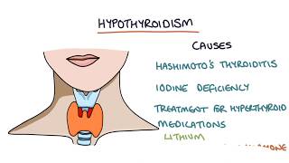 How to Diagnose Hashimotos Thyroiditis Every Thyroid Patients Needs THESE Tests [upl. by Celinka326]