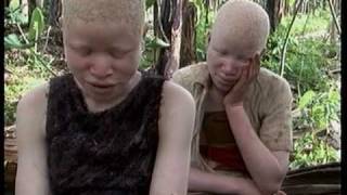 Deadly Hunt Albinos in Tanzania [upl. by Ragucci]