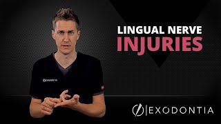 LINGUAL NERVE INJURIES IN DENTISTRY  OnlineExodontiacom [upl. by Ayotac185]